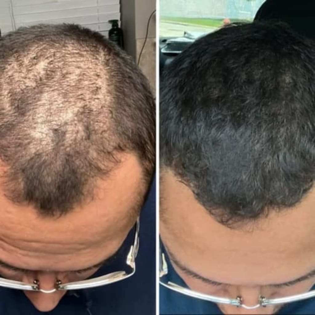 serum for your hair