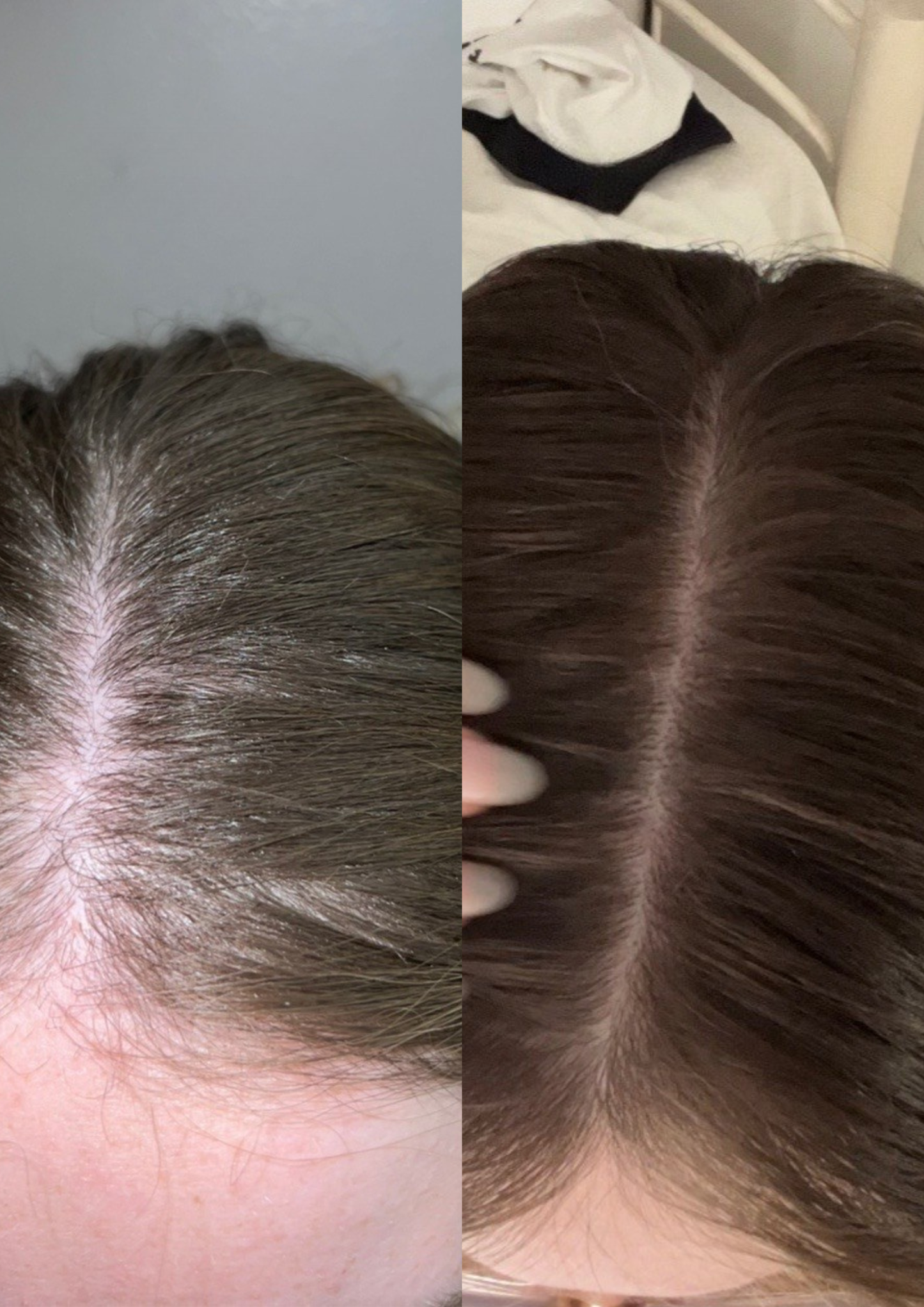 serum for your hair